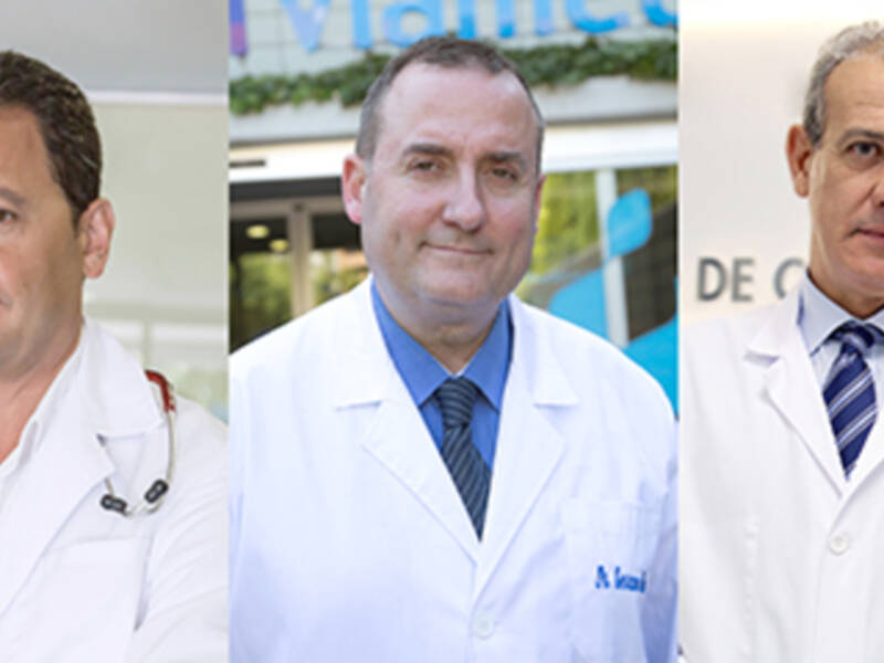 La fibrilación auricular cuadruplica el riesgo de ictus y duplica el riesgo de muerte